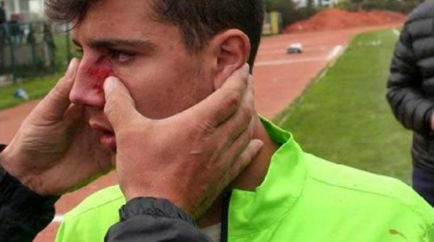 Amat&ouml;r Lig Ma&ccedil;ında Saha Karıştı: 5 Yaralı