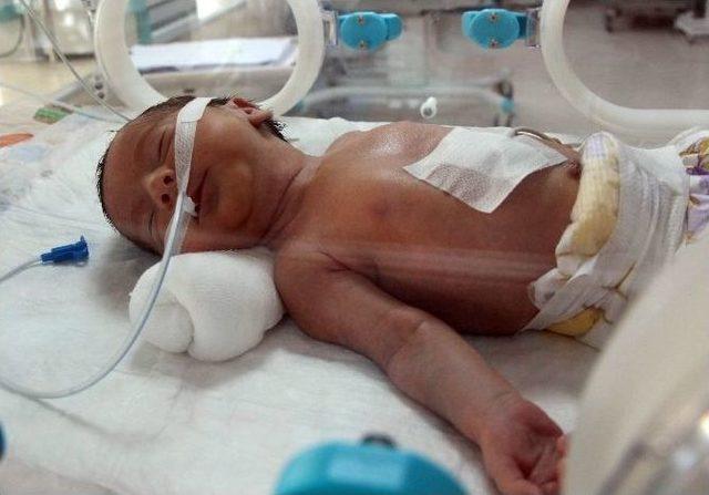 (özel Haber) Anne Karnında Teşhis Bebeğin Hayatını Kurtardı