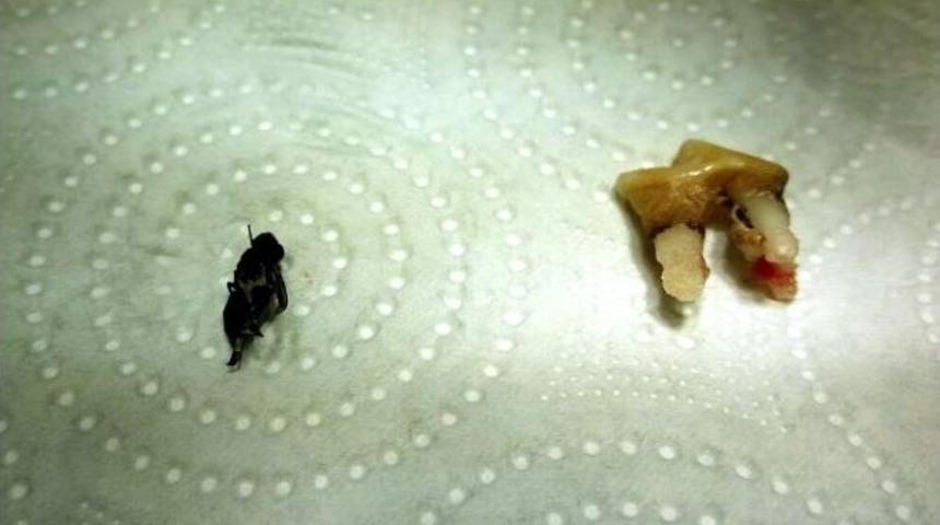 Ağrılarının Nedeni Arıymış