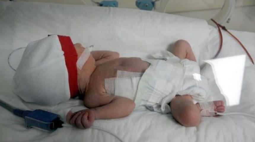 Bir Günlük Bebeğe Yemek Borusu Ameliyatı