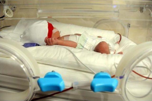 Bir Günlük Bebeğe Yemek Borusu Ameliyatı 2