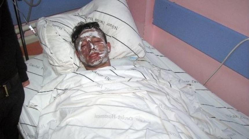 Isınmak İ&ccedil;in Yaktıkları Ateşle Yandılar