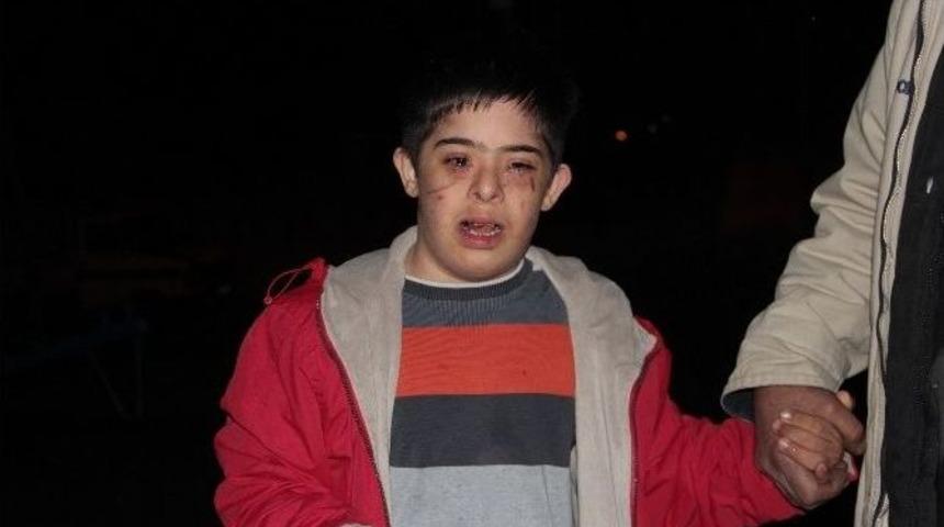 Down Sendromlu &Ccedil;ocuk Okuldan Eve Darp Edilmiş Halde D&ouml;nd&uuml;
