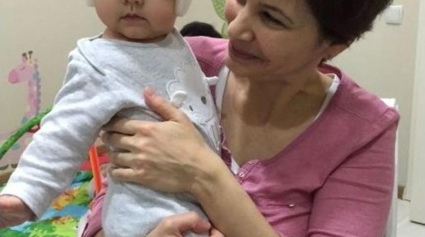 Bebeklerdeki Kafatası Şekil Bozukluklarına Dikkat