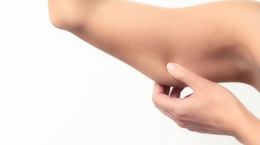 Sarkmalara Karşı Estetik Kol Germe Ameliyatı