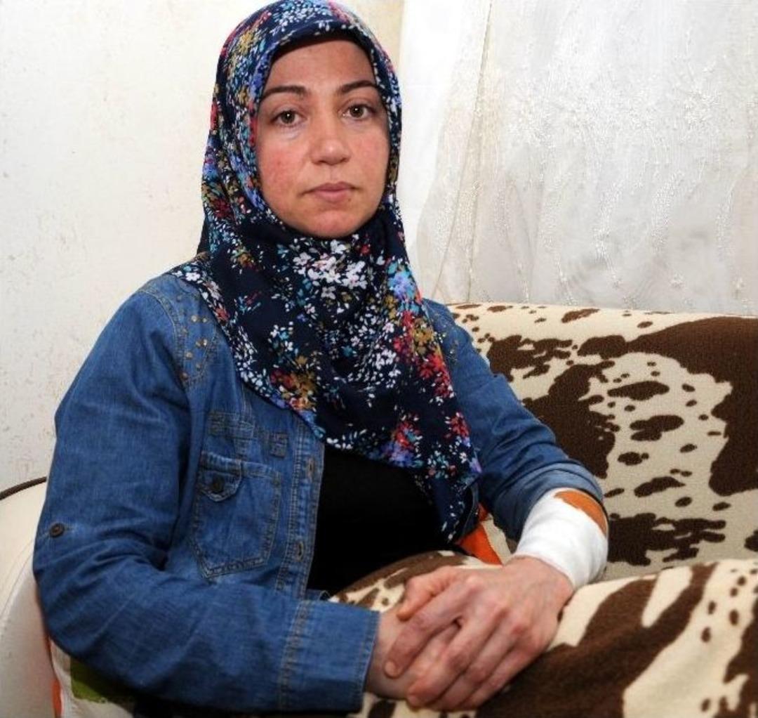 Barınakta K&ouml;pek Saldırısı: 2 Yaralı