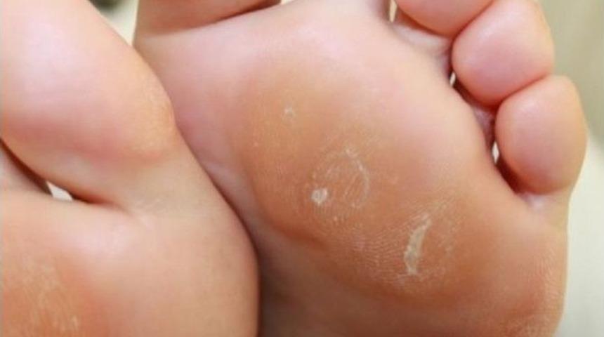 Yanlış Y&uuml;r&uuml;me Nasıra Davetiye &Ccedil;ıkarıyor