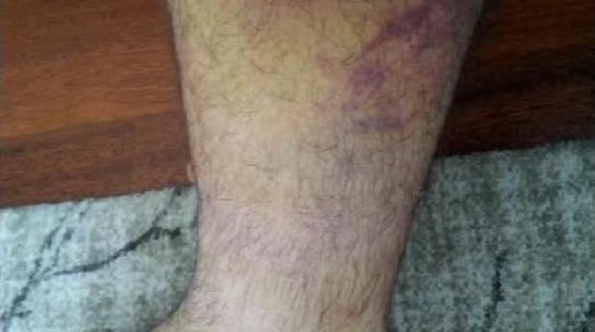 Savcılıktan 17 Polise Takipsizlik Kararı: G&ouml;sterilerin Barış&ccedil;ıl Olduğunu Kabul Etmek M&uuml;mk&uuml;n Değil