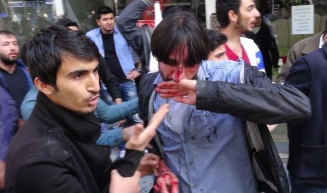 Hdp&rsquo;liler İle Vatandaşlar Birbirine Girdi