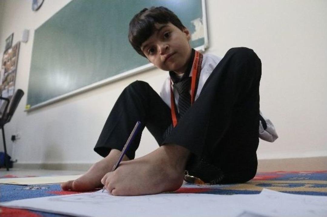 (&ouml;zel Haber) Ayağıyla &Ccedil;izdiği Resimleri Satarak Aile B&uuml;t&ccedil;esine Katkı Sağlıyor