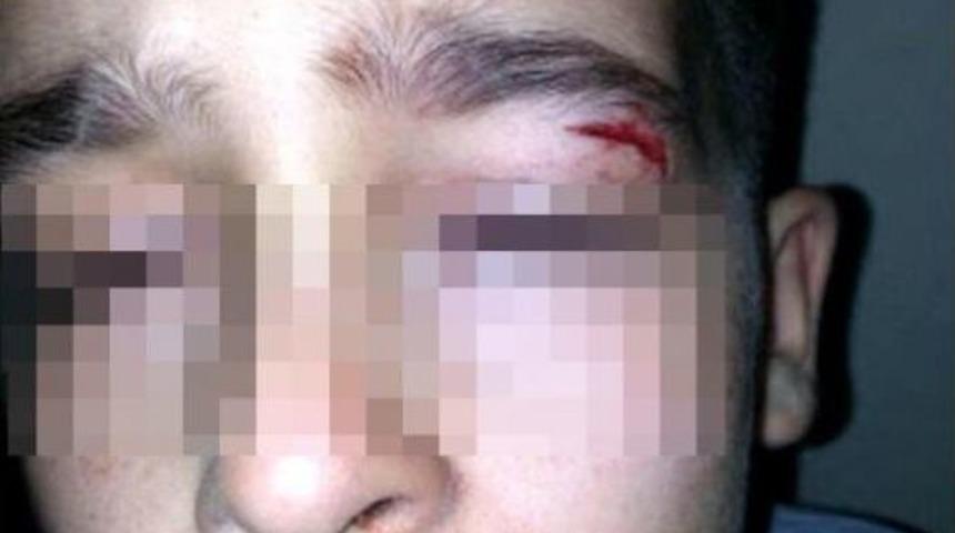 Kitapla Vurup Öğrencisini Yaralayan Öğretmene Dava