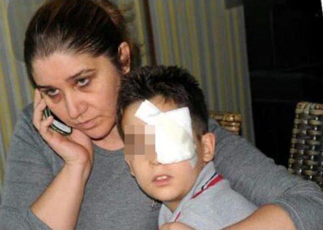 Kitapla Vurup Öğrencisini Yaralayan Öğretmene Dava 1