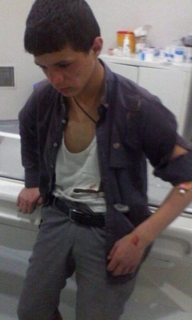 13 Yaşındaki &Ccedil;ocuğu Darp Ettiler İddiası 1