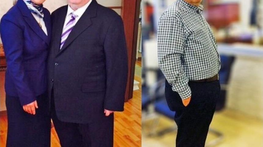 T&uuml;p Mide Ameliyatı İle Hem Şekeri Hem De Hipertansiyonu Yendi