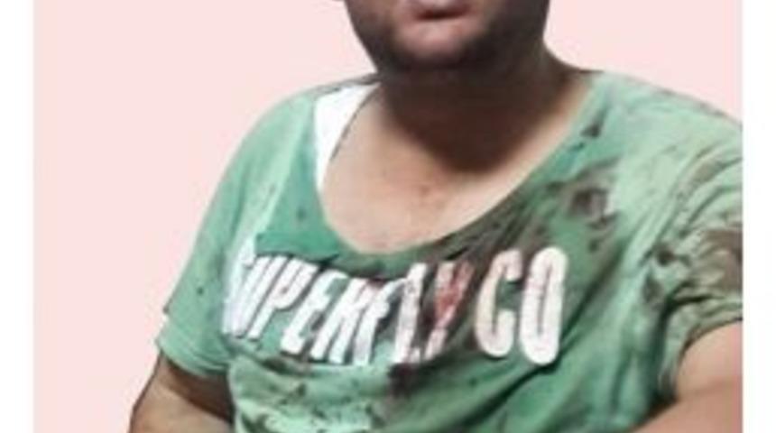 Deliyle Şaka Kanlı Bitti