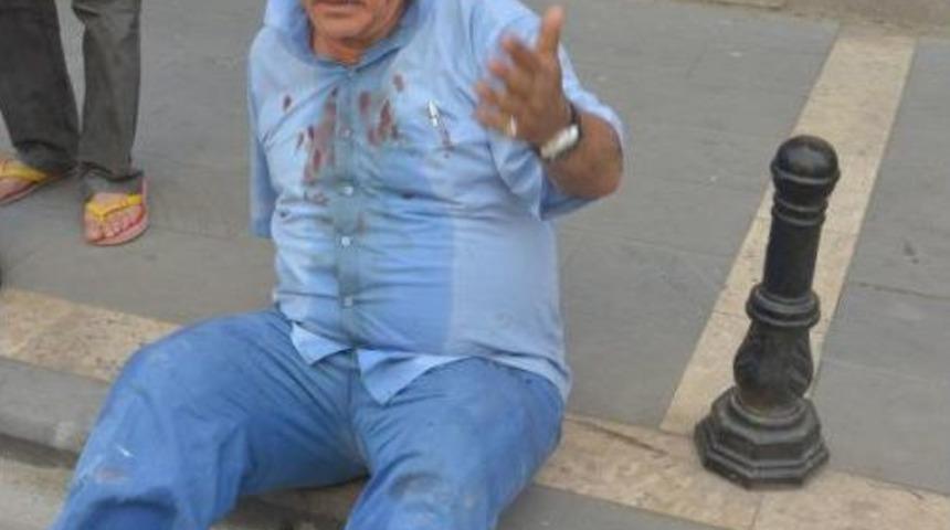 Esp'li Pişkinbaş, Suru&ccedil;'taki Patlamadan Da Yaralı Kurtuldu