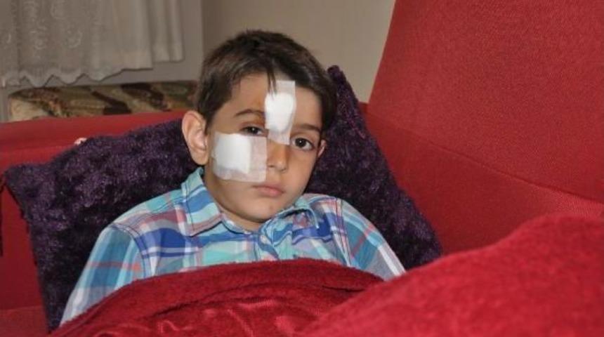 İznik&rsquo;Te Sokak K&ouml;peği 7 Yaşındaki &Ccedil;ocuğun Y&uuml;z&uuml;n&uuml; Isırdı