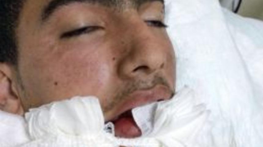 Parti Bayrağı Asan Suriyeli &Ccedil;ocuğa Elektrik &Ccedil;arptı