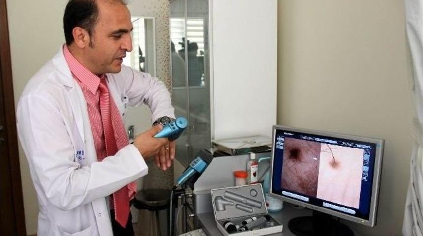 Deri Kanserlerinde Erken Teşhis Çok Önemli