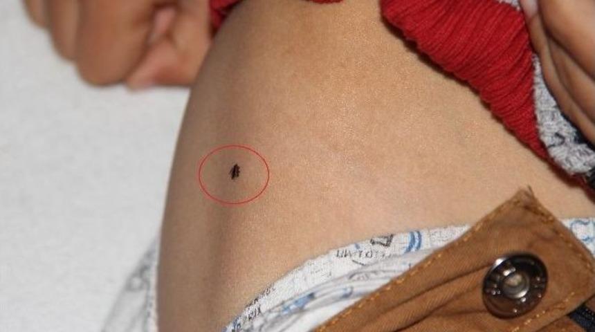 Kenenin Isırdığı &Ccedil;ocuk Hastaneye Kaldırıldı