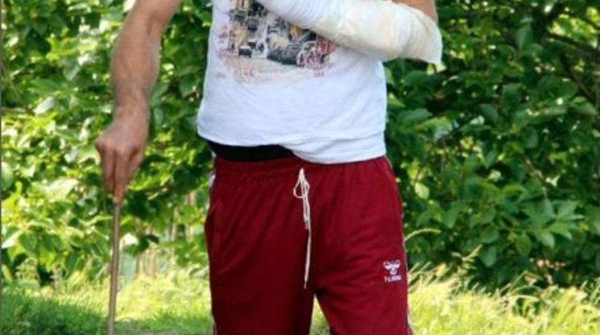 Bel Ameliyatında Kolu Yandı