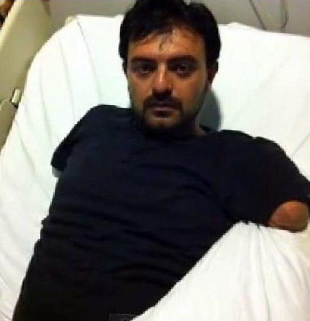 Adli Tıp: &Ouml;l&uuml;m Riskini Artıran &Ccedil;ift Kol Ve Bacak Nakli Uygun Değil 1