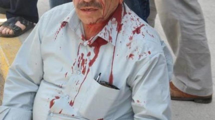 Yeğenleri, Cami Imamını Keserle D&ouml;vd&uuml;