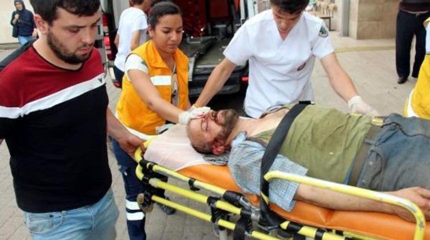 Lastikten Fırlayan Par&ccedil;a Y&uuml;z&uuml;n&uuml; Yaraladı