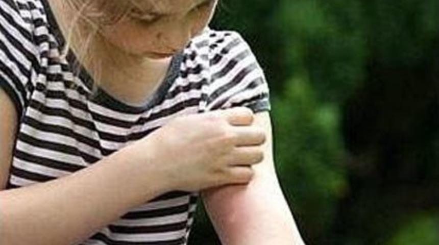 Yaz Aylarında B&ouml;cek Isırmalarına Dikkat!