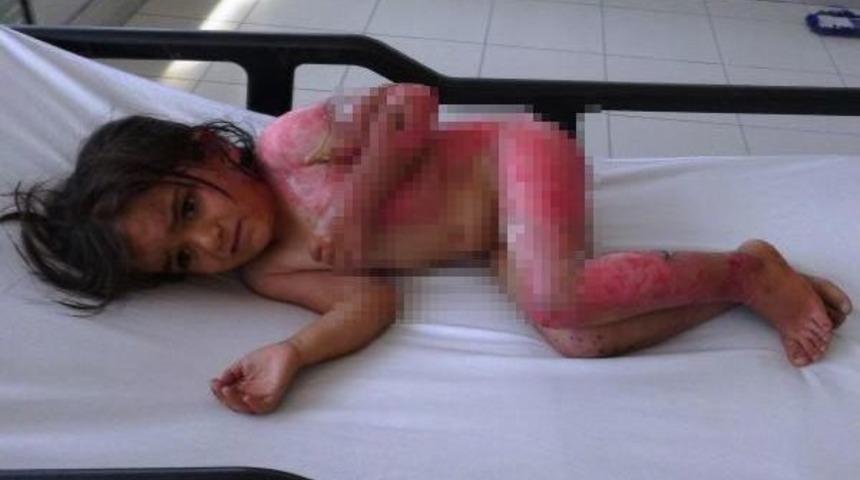 6 Yaşındaki Song&uuml;l'&uuml;n &Uuml;zerine Sıcak Su Kazanı Devrildi