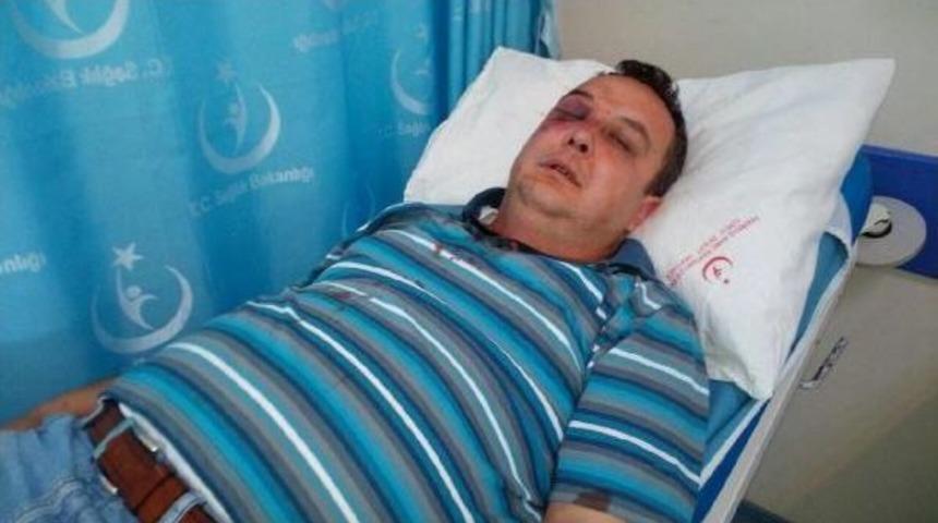 Suyu Kesilen Kuaf&ouml;r, G&ouml;revliyi Hastanelik Etti