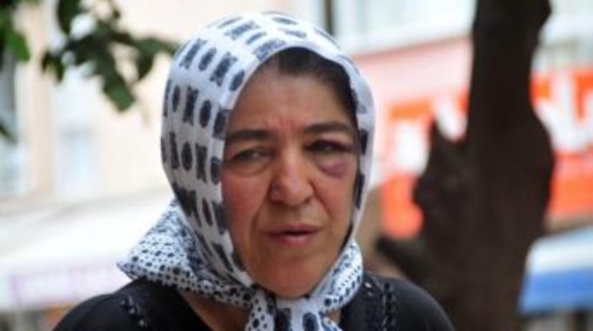 Oğlunun Caddede D&ouml;vd&uuml;ğ&uuml; Anne Bu Hale Geldi