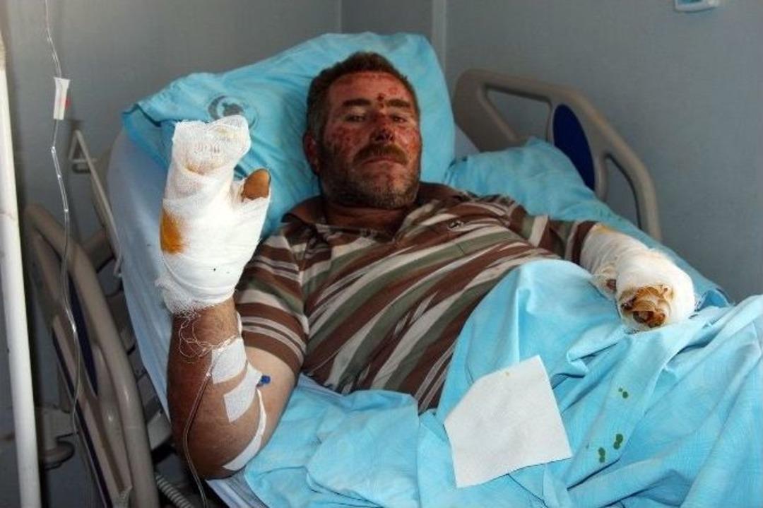 Kobani&rsquo;deki Saldırıda Yaralananlar Yaşadıklarını Anlattı