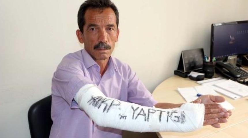 Kırılan Kolundaki Al&ccedil;ıya 'akp'nin Yaptığı' Diye Yazdı