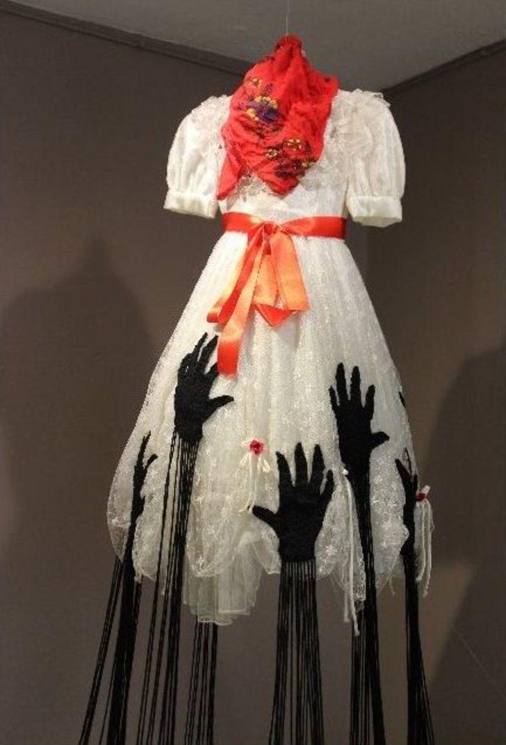 (özel Haber) “bir Çocuğun Kabusu” G3