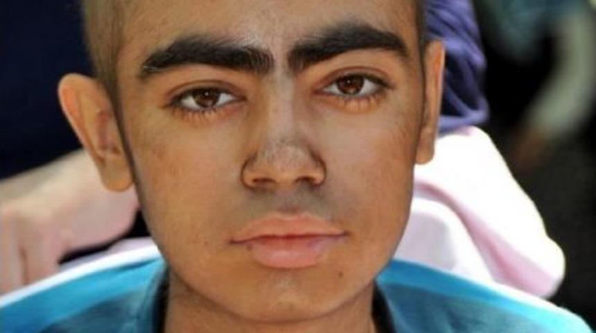 Ağabeyinin Iliğiyle Yaşama Tutundu