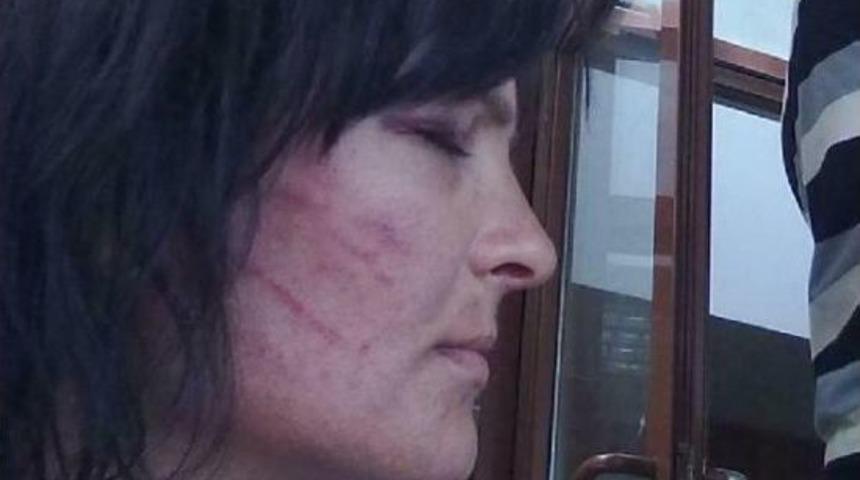 Doctor Fined Over Inaccurate Report On Tortured Woman In Turkey's West