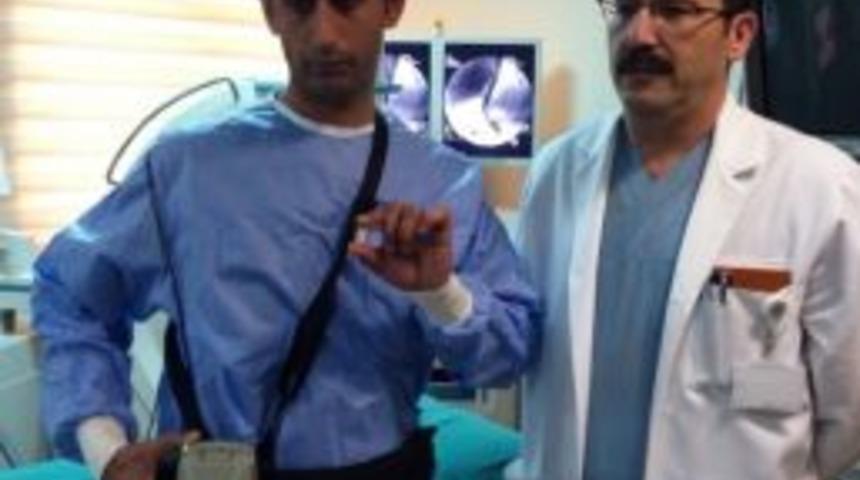 İnce Bağırsak Hastalıklarına Kameralı Teşhis