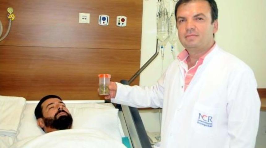 Safra Kesesinden 512 Taş &Ccedil;ıktı