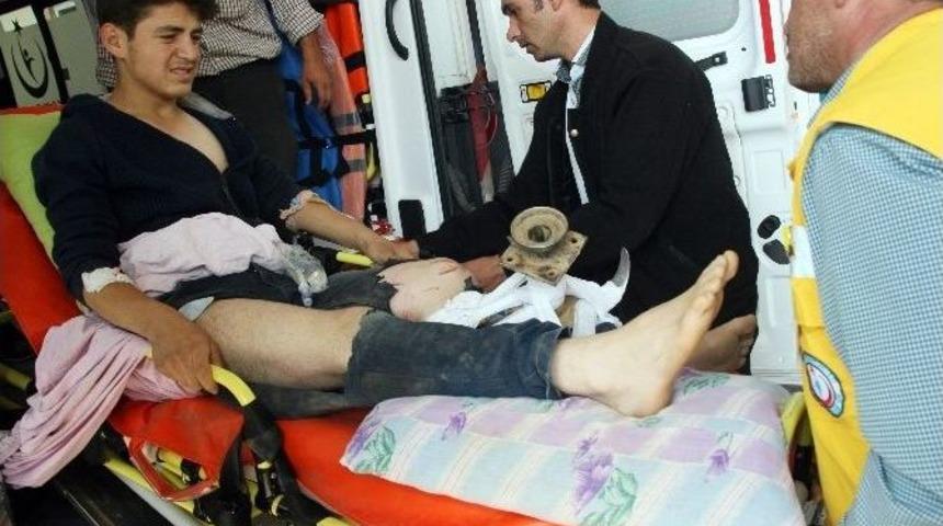 &rsquo;15 Yaşındaki Gen&ccedil; Ayağına Saplanan &Ccedil;apa Makinesi İle Saatlerce Bekletildi&rsquo; İddiası