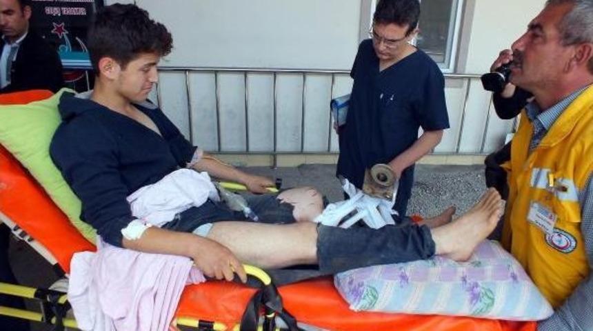 Ayağını &Ccedil;apa Makinesine Kaptırdı