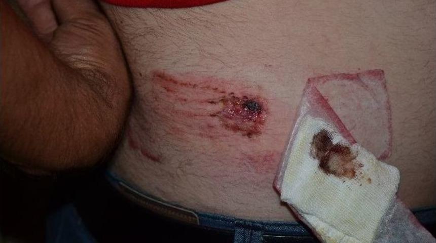 Bimer&rsquo;e Şikayet Eden Komşusunun D&uuml;kkanını Orakla Bastı