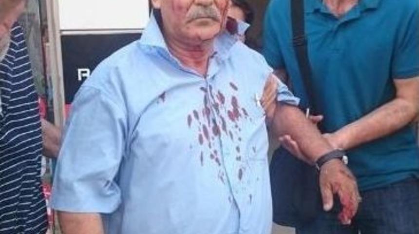 İki Bombalı Saldırıdan Sağ Kurtuldu