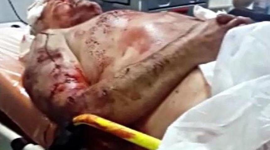 Bek&ccedil;inin K&ouml;pek Saldırısında Par&ccedil;alanan Kulağı Alındı