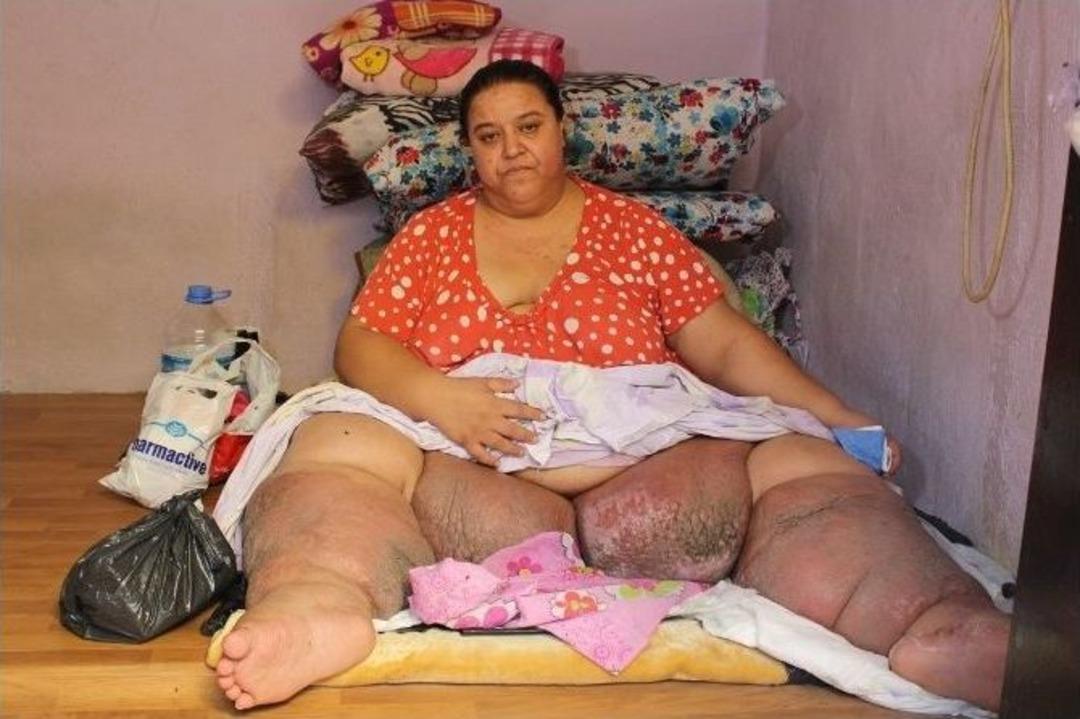 Tek G&ouml;z Odada 220 Kiloyla Yaşam Savaşı