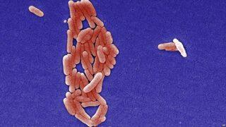 Salmonella virüsü nedir? Belirtileri nelerdir? Salmonella nasıl bulaşır? 