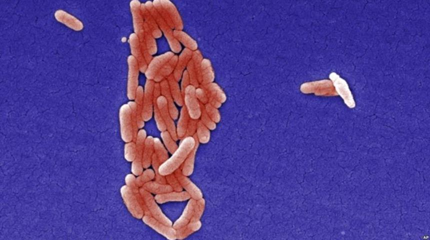 Salmonella virüsü nedir? Belirtileri nelerdir? Salmonella nasıl bulaşır? 