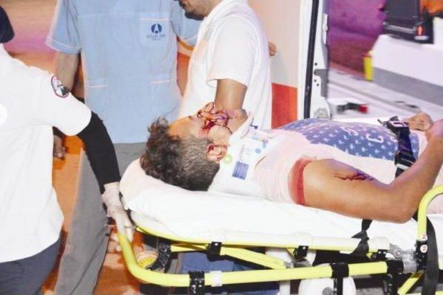 Otomobil Zeytin Ağacına &Ccedil;aptı: 2 Yaralı 3