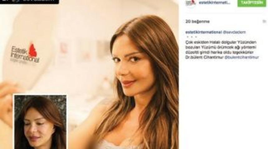 Sevda Demirel Örümcek Ağı Estetiği Yaptırdı