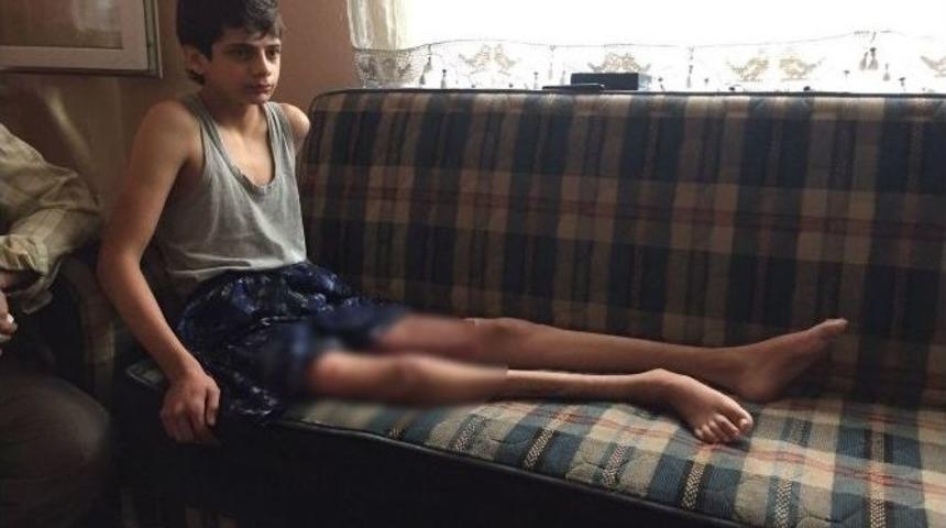 (&ouml;zel Haber) Suriye&rsquo;de Savaştan Ka&ccedil;tı, Bir Ay Sonra Kazada Sakat Kaldı